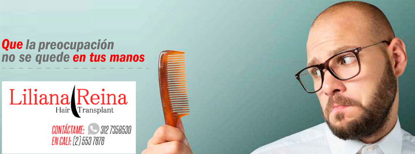 implante capilar transplante