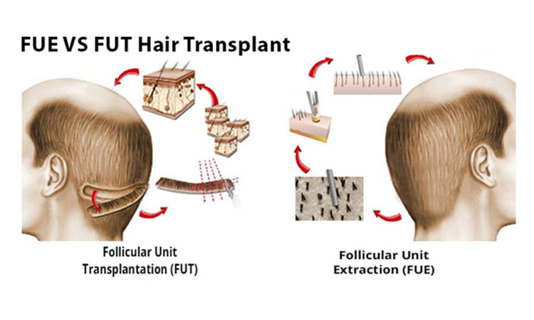 Metodo Fue Metodo Fut