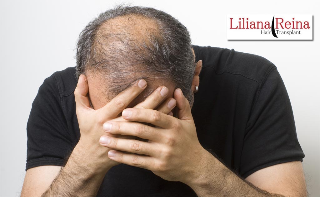 Pérdida del Cabello